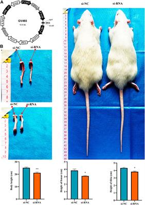 Hsa_circ_0008870 suppresses bone formation of growth plate through inhibition of miR-185-3p/ MAPK1 axis in idiopathic short stature